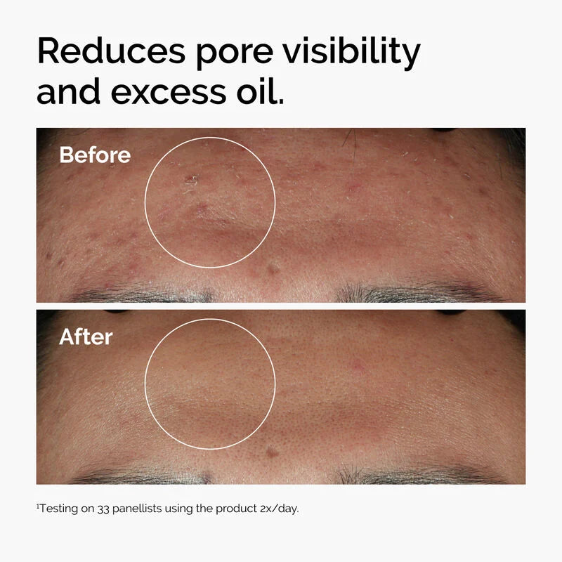 The Ordinary Niacinamide 10% + Zinc 1% - 30ml khubsurti.pk