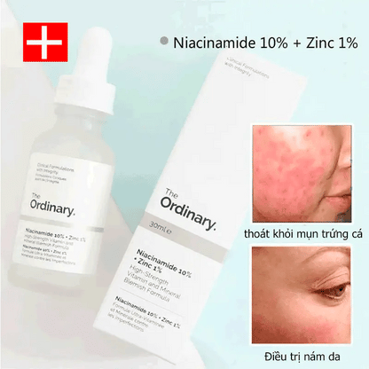 The Ordinary Niacinamide 10% + Zinc 1% - 30ml khubsurti.pk