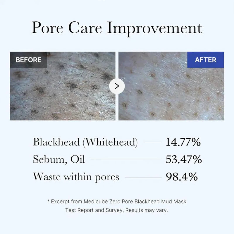 Medicube Zero Pore Blackhead Mud Mask - 100g - Free Applicator khubsurti.pk