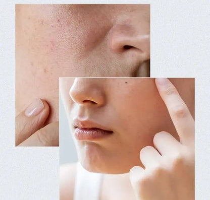 Anua Birch 70 Moisture Boosting Serum - 30ml