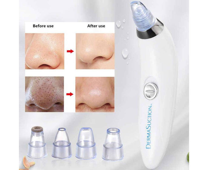 Derma Suction Blackheads Remover 3 In 1 Black Head Remover Machine-acne Pimple Pore Cleaner Vacuum Suction Tool khubsurti.pk