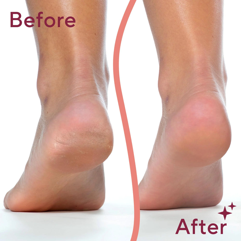 Electric Foot File & Callus Remover
