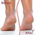 Electric Foot File & Callus Remover
