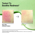 ANUA Azelaic Acid 10 Hyaluron Redness Soothing Serum 30ml for sensitive and blemish-prone skin