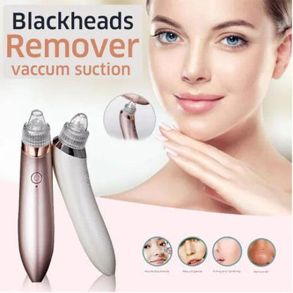 5in1 Blackhead Vacuum Acne Cleaner – Pore Cleanser & Skin Care Tool khubsurti.pk