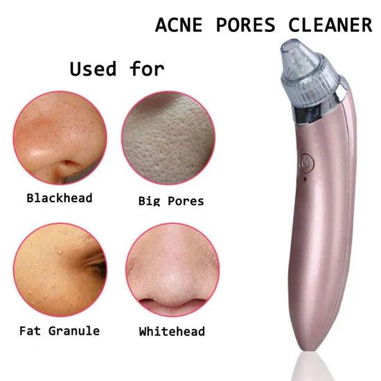 5in1 Blackhead Vacuum Acne Cleaner – Pore Cleanser & Skin Care Tool khubsurti.pk