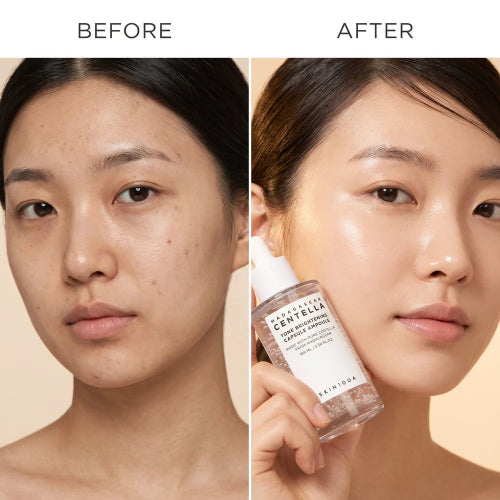  Madagascar Centella Tone Brightening Capsule Ampoule 100ml with brightening and soothing skincare formula