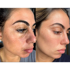 Skinroselle Retinal Shot Firm Skin Tightening Booster