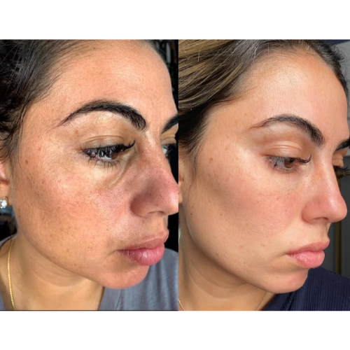 Skinroselle Retinal Shot Firm Skin Tightening Booster