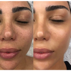Skin roselle Retinal Shot Firm Skin Tightening Booster