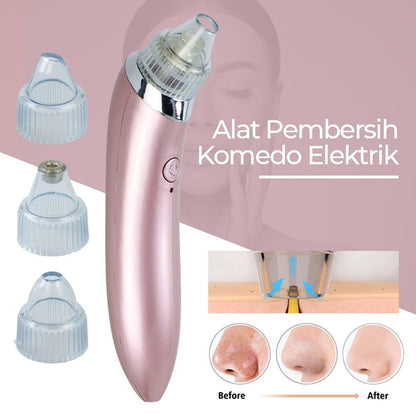 5in1 Blackhead Vacuum Acne Cleaner – Pore Cleanser & Skin Care Tool khubsurti.pk
